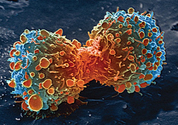 Il momento della divisione cellulare durante la creazione del cancro (fonte: United States: National Institutes of Health) © Ansa