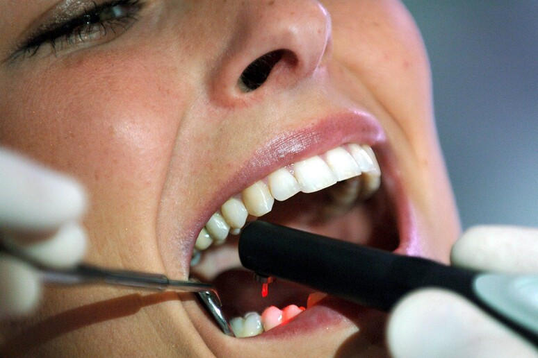Un dentifricio colora-placca contro l 'arterosclerosi - RIPRODUZIONE RISERVATA