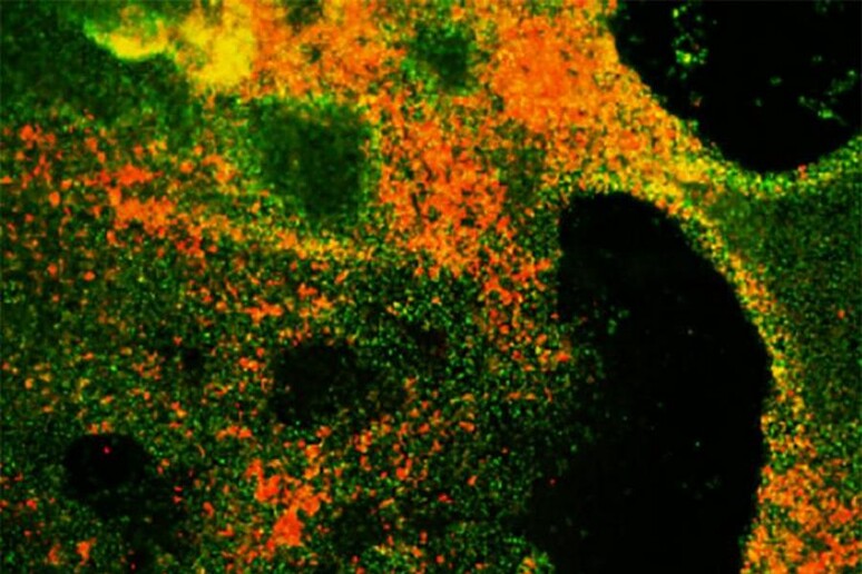 Le cellule del tumore del polmone a piccole cellule riprodotto in provetta (fonte: Chen et al., 2019) - RIPRODUZIONE RISERVATA