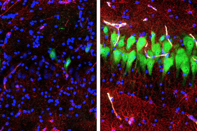 A sinistra le cellule del cervello di maiale dopo la morte, a destra dopo la perfusione (fonte: Stefano G. Daniele &amp; Zvonimir Vrselja; Sestan Laboratory; Yale School of Medicine) - RIPRODUZIONE RISERVATA