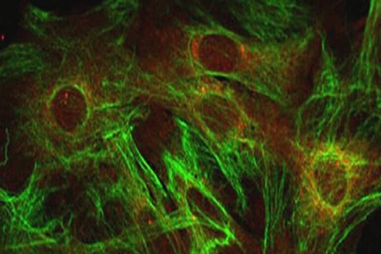 Le cellule nervose chiamate astrociti sono coinvolte nella comparsa della Sla (fonte: Oregon State University) - RIPRODUZIONE RISERVATA