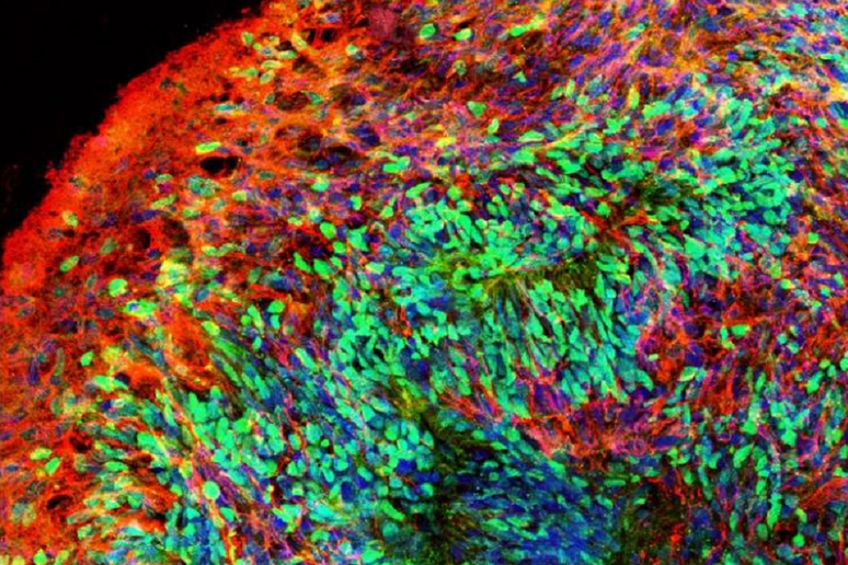Particolare di un organoide del cervello umano (fonte: Ranjie Xu/Rutgers University-New Brunswick) - RIPRODUZIONE RISERVATA