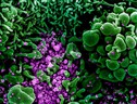 Particelle del virus SarsCoV2 (in violetto) sulla superficie di una cellula (fonte: NIAID) (ANSA)