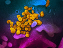 Particelle del coronavirus SarsCov2 sulla superficie di una cellula, ottenute dal Niaid (fonte: NIAID-RML) (ANSA)