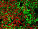 Cellule del tumore del colon (fonte: NCI Center for Cancer Research) (ANSA)