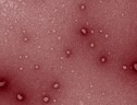 Immagine al microscopio elettronico delle nanoparticelle utilizzate per stimolare il sistema immunitario contro i tumori (fonte: Nicki Watson, W. M. Keck Microscopy Facility/Whitehead Institute, colorazione da MIT News) (ANSA)