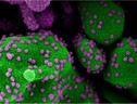 Particelle del virus SarsCoV2 su una cellula (fonte: NIAID) (ANSA)