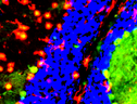 Cellule della microglia di topo (fonte: NICHD/A. Cougnoux, F.D. Porter) (ANSA)