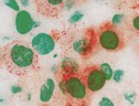 In rosso la proteina Spike con cui il virus attacca le cellule dell’epitelio bronchiale (fonte: Humanitas) (ANSA)