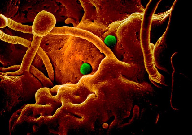 In verde particelle del coronavirus responsabile della Mers su cellule di cammello (fonte: NIAID, Colorado State University) © Ansa