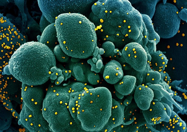 In giallo particelle del virus SarsCoV2 su una cellula (fonte: NIAID) © Ansa