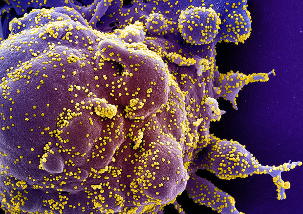 Una cellule attaccata dal virus SarsCoV2 (fonte:National Institute of Allergy and Infectious Diseases, NIH) © Ansa