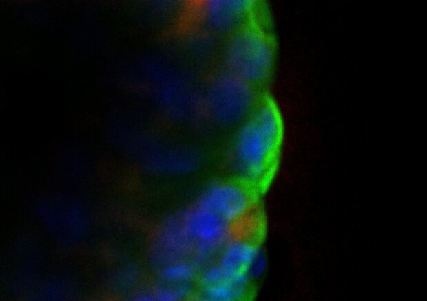 Organoide di fegato infettato con Sars-CoV-2 (il virus è in rosso) (Fonte: Teresa Brevini) © Ansa