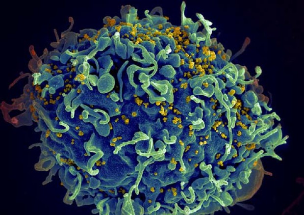 Una cellula umana attaccata dal virus Hiv (fonte: S. Pincus, E. Fischer, A. Athman, NIAID/NIH) © Ansa