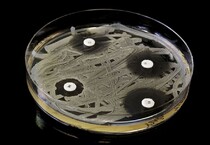 L'intelligenza artificiale accelera la ricerca sugli antibiotici contro i superbatteri (fonte: Pxfuel) (ANSA)