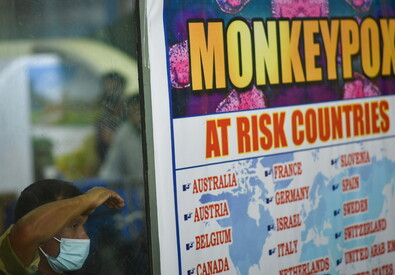 Dal 18 agosto scorso più 18 casi in Italia di vaiolo delle scimmie (ANSA)