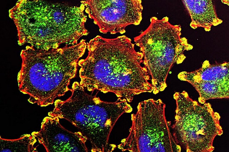 Cellule metastatiche di melanoma (fonte: Julio C. Valencia, NCI Center for Cancer Research, National Cancer Institute, NIH) - RIPRODUZIONE RISERVATA