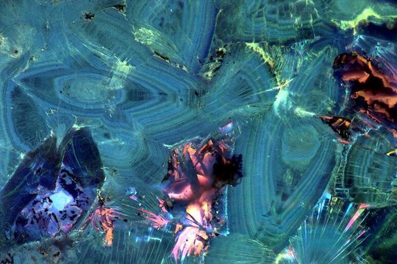 Immagine al microscopio a fluorescenza di un rene umano (fonte: Mayandi Sivaguru, Jessica Saw from Bruce Fouke Lab, Carl R. Woese Institute for Genomic Biology, U. of I.) - RIPRODUZIONE RISERVATA