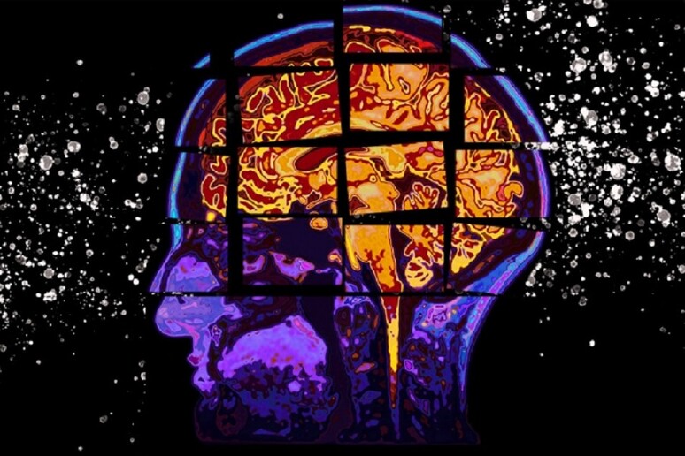Un test basato sull 'intelligenza artificiale, messo a punto al Mit, riesce a prevedere la progressione del morbo di Alzheimer nei due anni successivi (fonte: Christine Daniloff, MIT) - RIPRODUZIONE RISERVATA