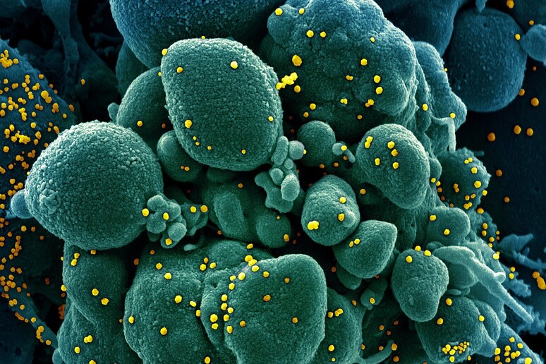 In giallo particelle del nuovo coronavirus su una cellula (fonte: NIAID) - RIPRODUZIONE RISERVATA