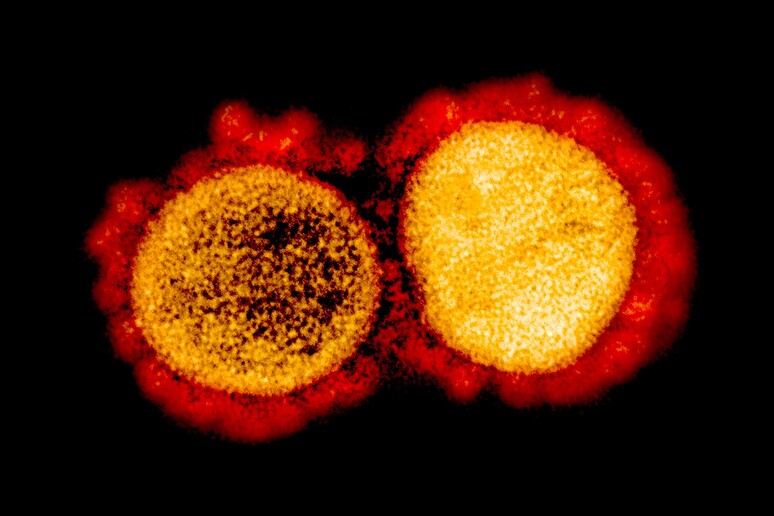 Particelle di coronavirus (fonte: NIAID) - RIPRODUZIONE RISERVATA
