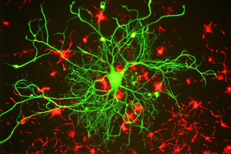 L 'enzima Hdca1 attiva la riparazione dei danni nel Dna dei neuroni (fonte: Gerry Shaw, CC BY-SA 3.0) - RIPRODUZIONE RISERVATA