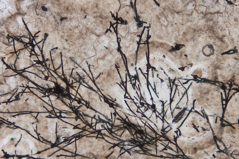 Immagine al microscopio di organismi fossili simili ai funghi, vecchi di 635 milioni di anni. (fonte: Andrew Czaja of University of Cincinnati) - RIPRODUZIONE RISERVATA