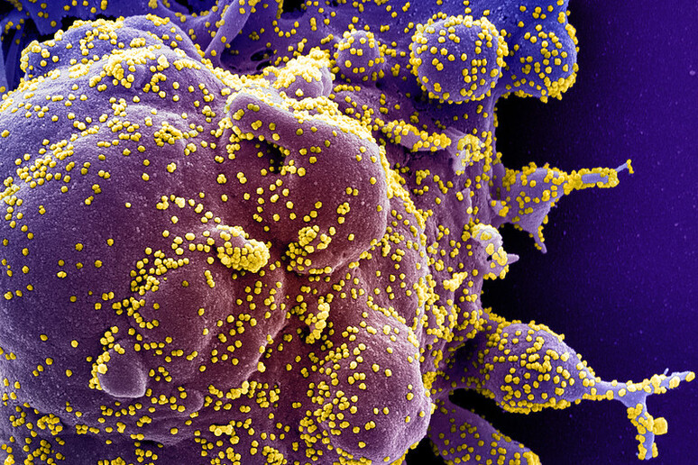 Una cellule attaccata dal virus SarsCoV2 (fonte:National Institute of Allergy and Infectious Diseases, NIH) - RIPRODUZIONE RISERVATA