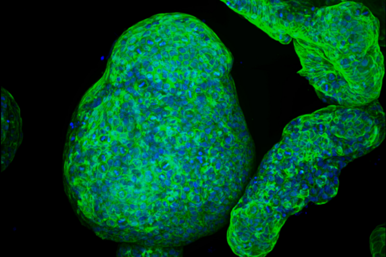 L 'organoide del pancreas (fonte: MIT/Cancer Research UK Manchester Institute) - RIPRODUZIONE RISERVATA